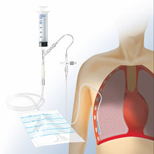 Conjunto completo para drenagem pleural e torácica – Conjunto completo segundo o método de Matthys