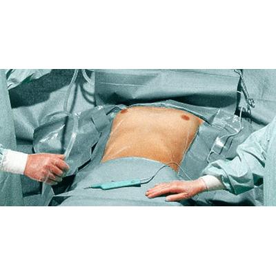 Conjunto Cardiovascular Hartmann Fdrape PP P3 | Pacote (3 peças)