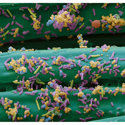 Cutimed Sorbact, Tamponade, antimikrobielle Wundauflage, steril – im Einsatz